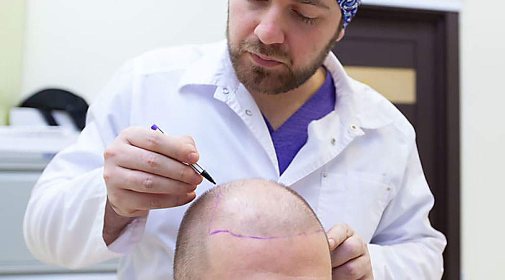 Allt Du Behöver Veta om Fettreducering genom Liposuction