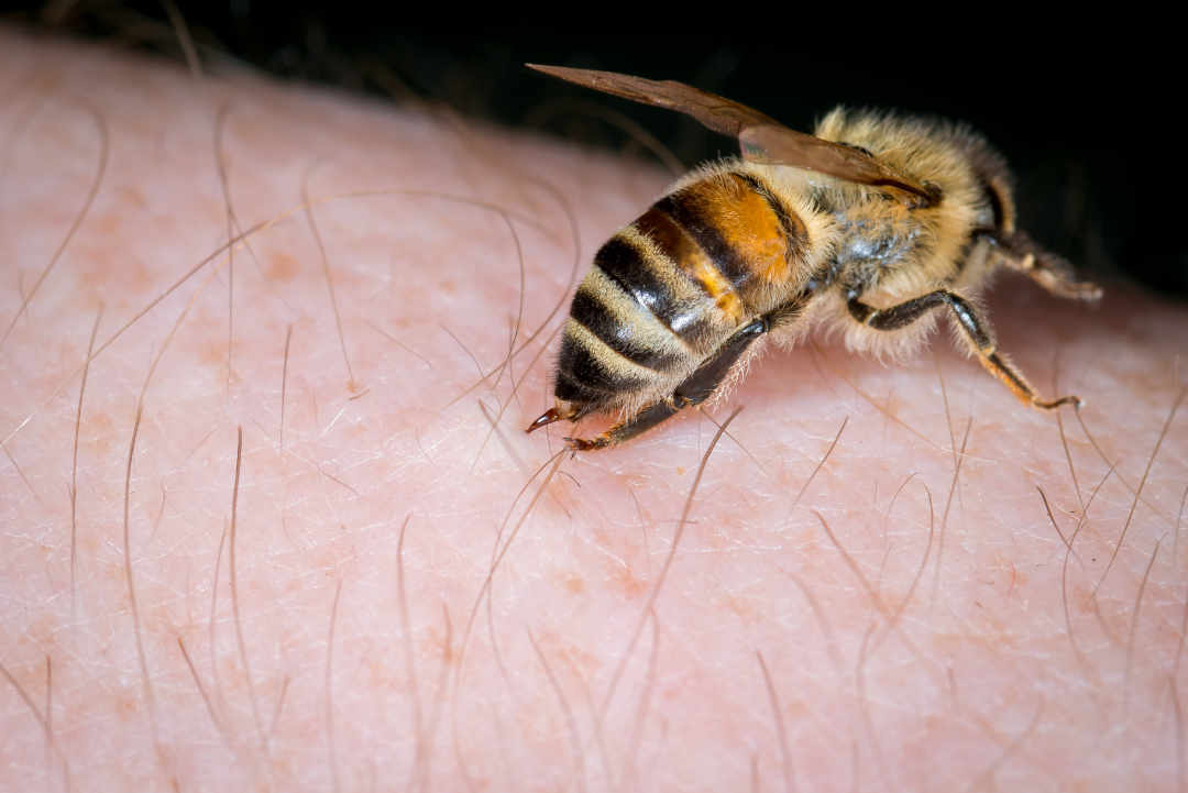 Was tun bei Bienenstichen?