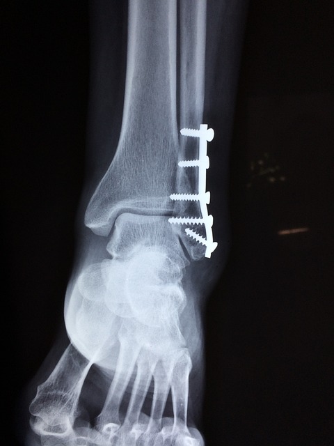Podiatrist Services: Comprehensive Foot and Ankle Care for Every Step!
