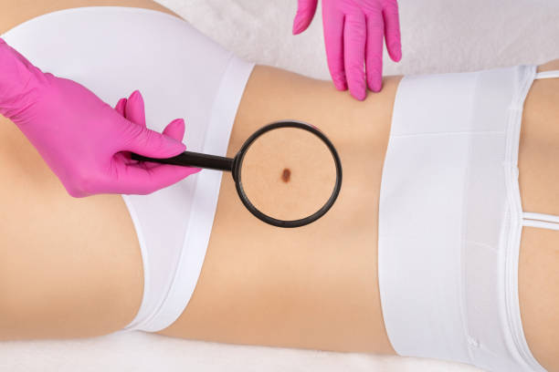 Demystifying Fat Removal: Unfolding the Science and Art Behind Liposuction