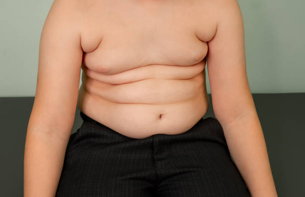 Embracing Change: An In-Depth Look at the Rising Popularity of Tummy Tuck Procedures