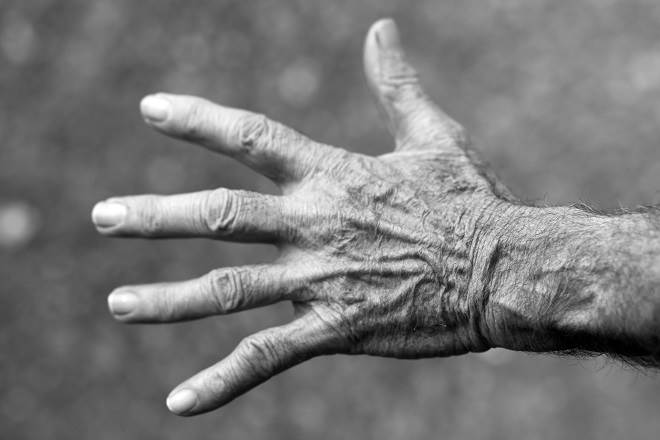 What Causes Rheumatoid Arthritis?