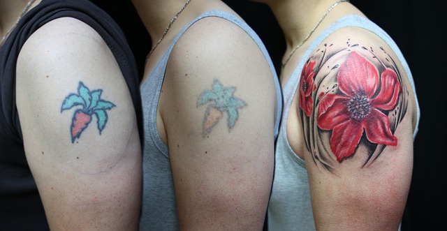 Eliminación de tattoo: guía práctica sobre piel y tratamientos láser