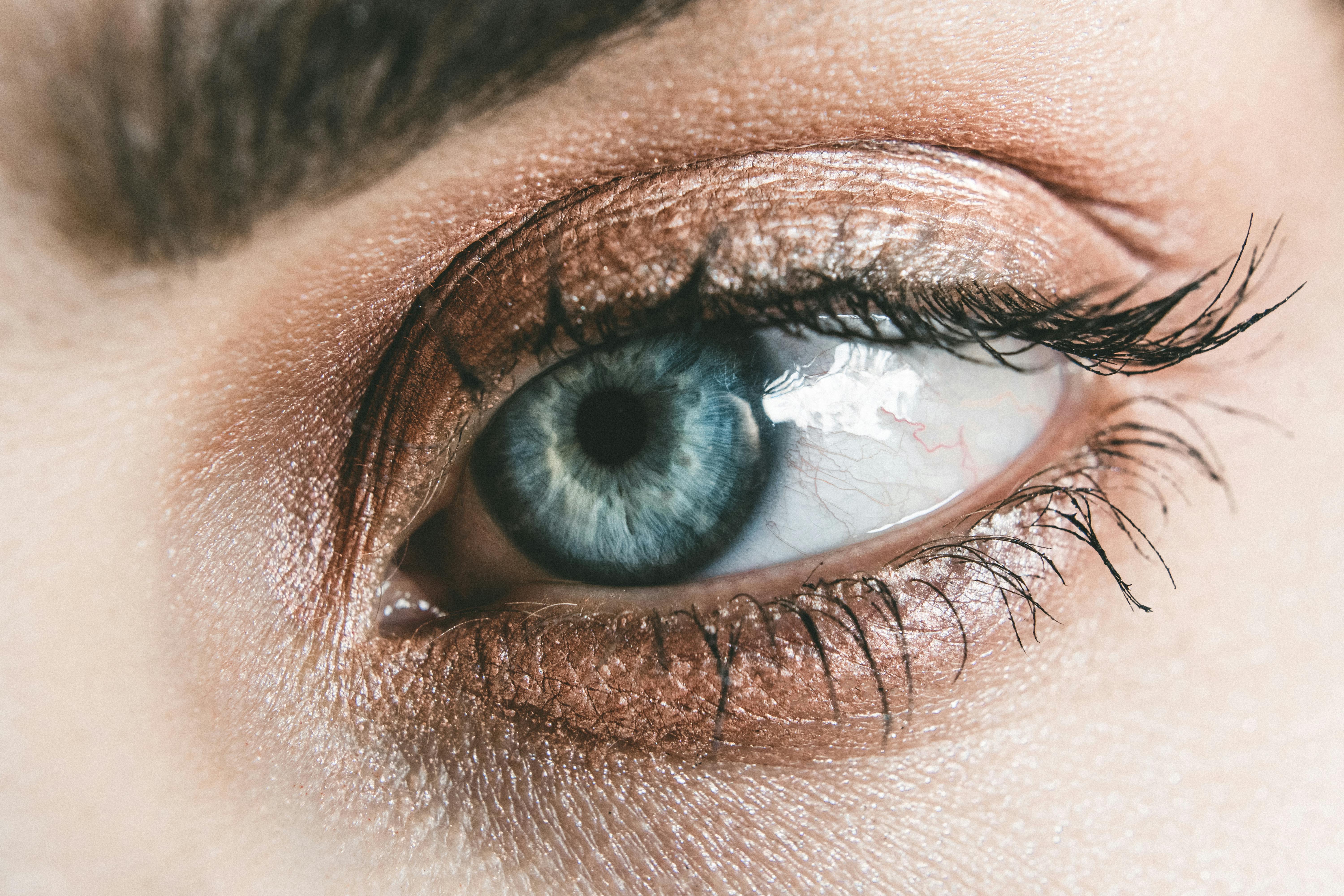 Demystifying Eye Bags: Causes and Effective Treatments