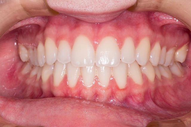 Tandheelkundige Implantaten: Een Revolutie in Moderne Tandheelkunde