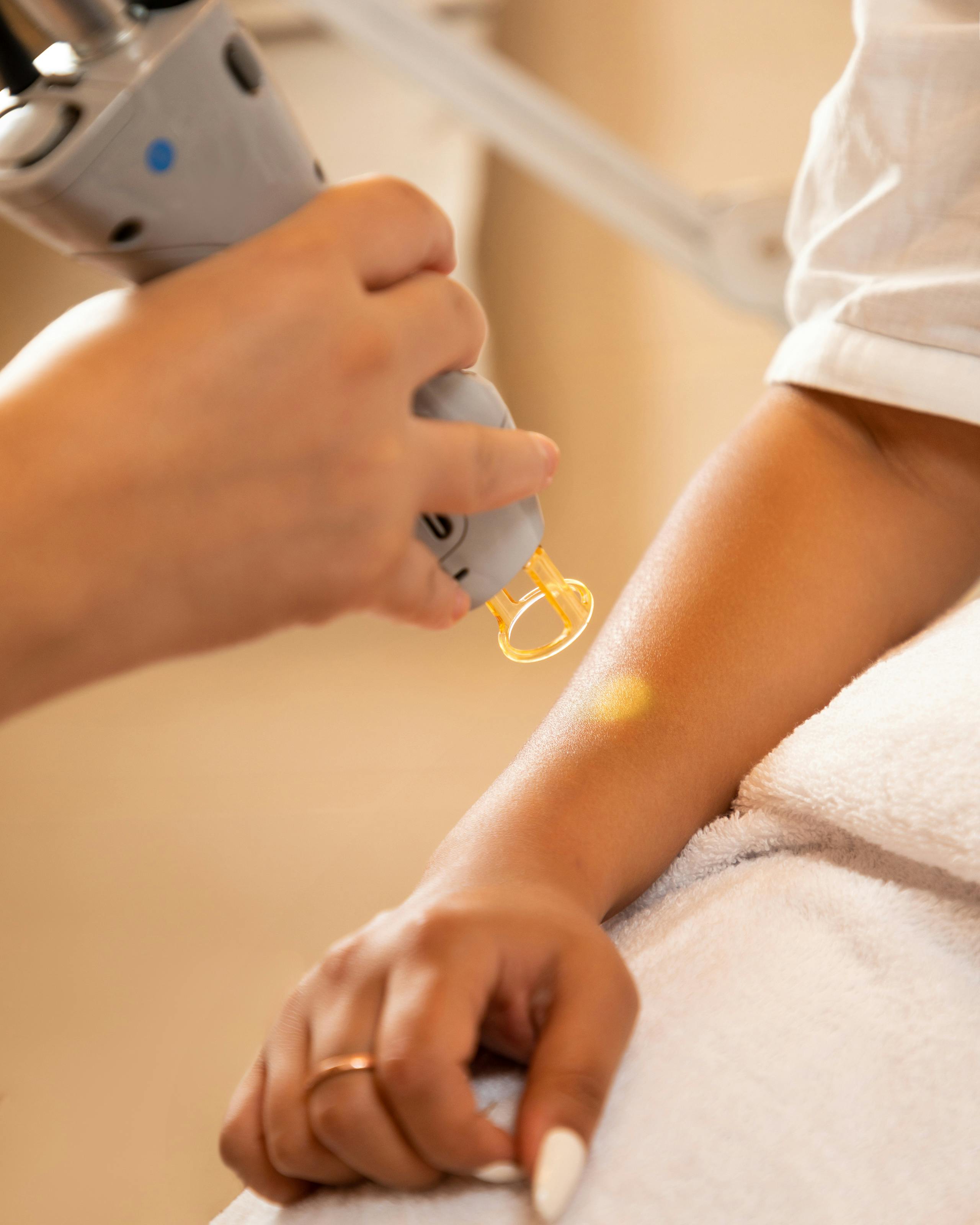 The Science and Efficacy of Laser Hair Removal