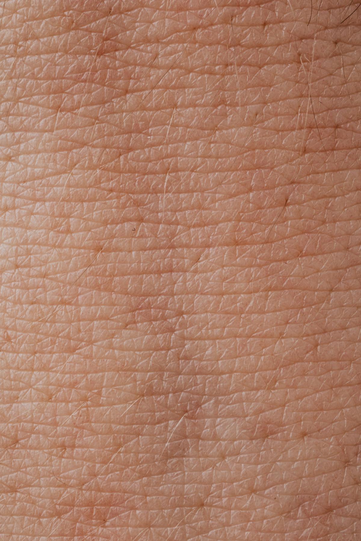 Demystifying the Role of Moisturizers in Skin Health: Past, Present and Future