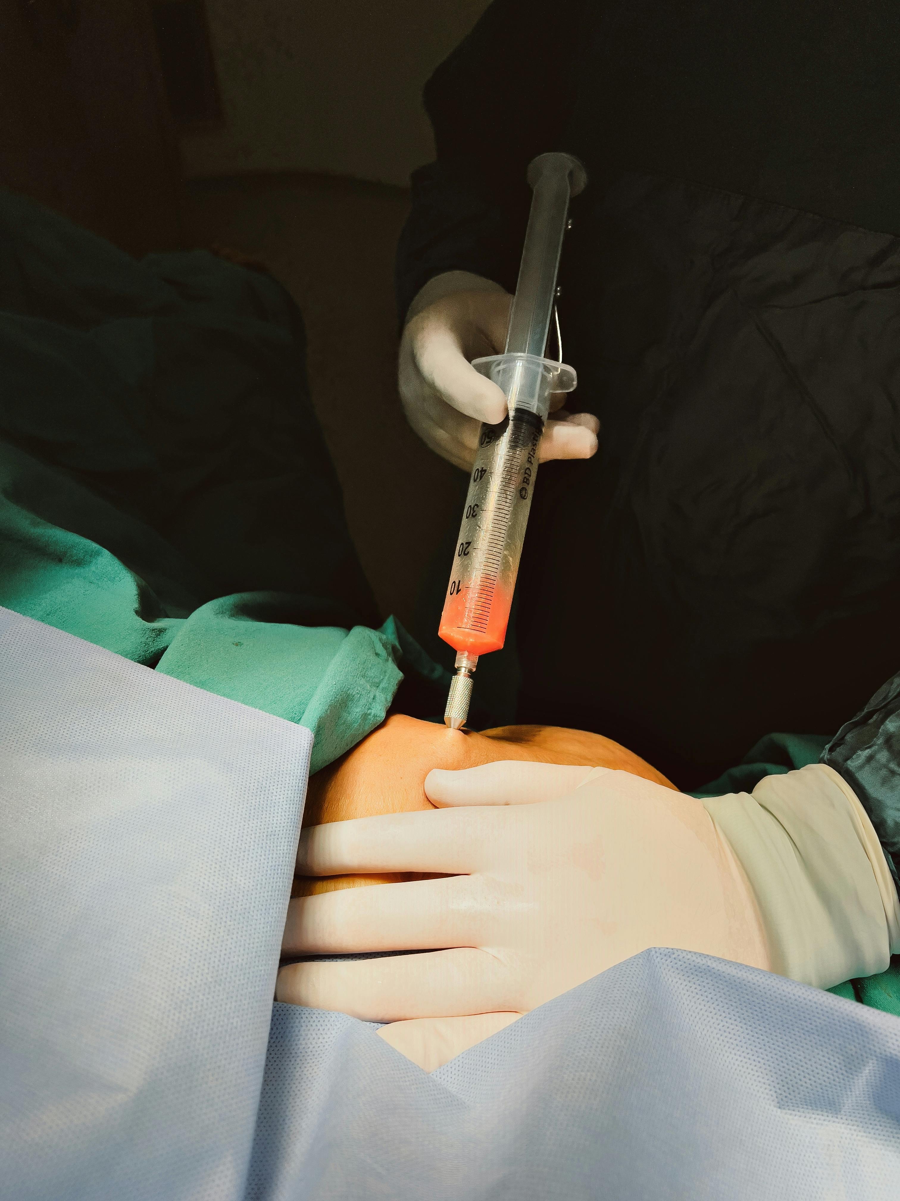 The Art and Science of Fat Removal: Unveiling the Mysteries of Liposuction