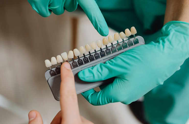 Cómo encontrar las mejores clínicas dentales para implantes dentales
