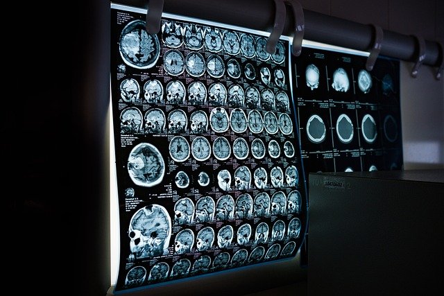 Title: Legal Implications of Artificial Intelligence in Healthcare