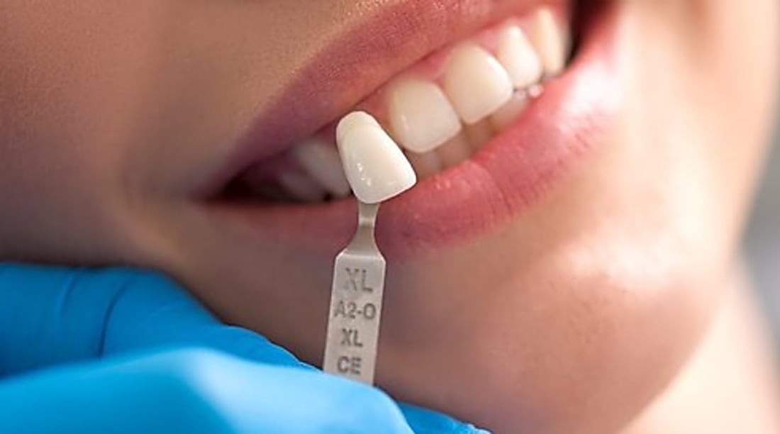A fogászati implantátumok