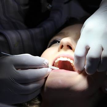 Schraubenlose Zahnimplantate: Funktion und Vorteile erklärt