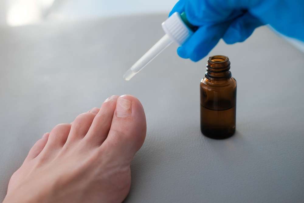 Understanding Toenail Fungus Treatment: Safe and Effective Solutions for Healthier Nails